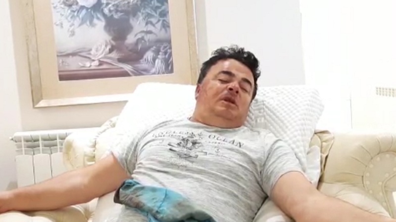 Biznesmeni Çangu pëson hemorragji, shoqërohen disa të dyshuar